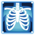 :xray: